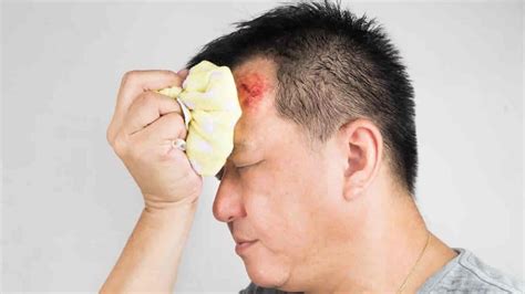 image of head injury bandage