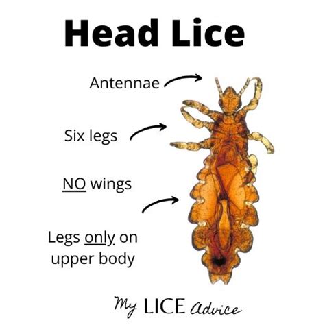 Head Lice Names