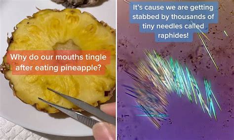 Headache After Pineapple