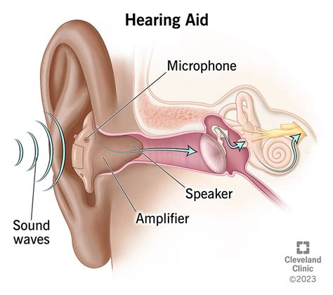 Hearing Aid Definition Easy
