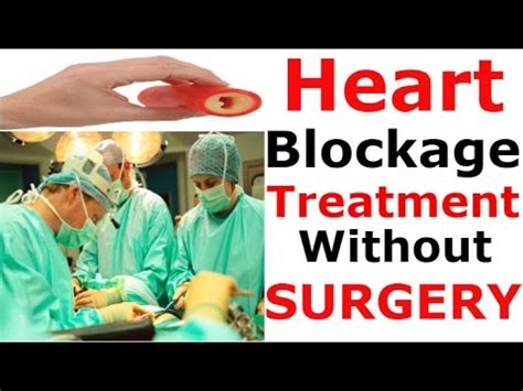 Heart blockage treatment Without surgery Without medicine DIP DIET