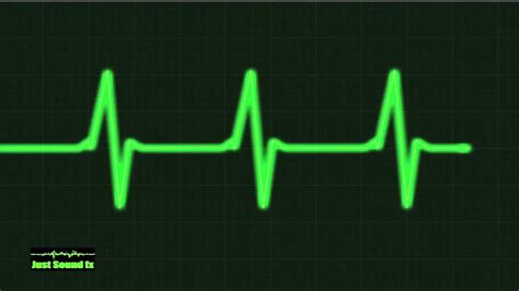 Heart Rate Monitor Noise