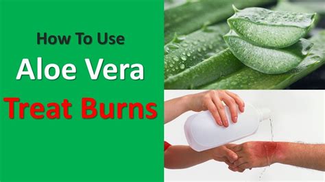 heating pad burn treatment with aloe vera