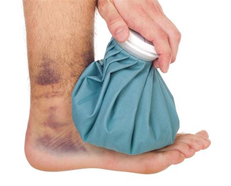 Heating Pad On Bruise