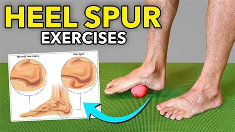Heel Spur Exercises To Avoid