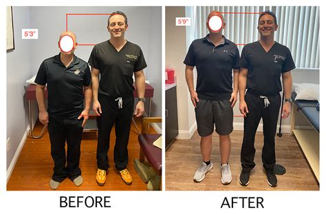 Unlock Your Confidence: Height Surgery Before & After Transformations