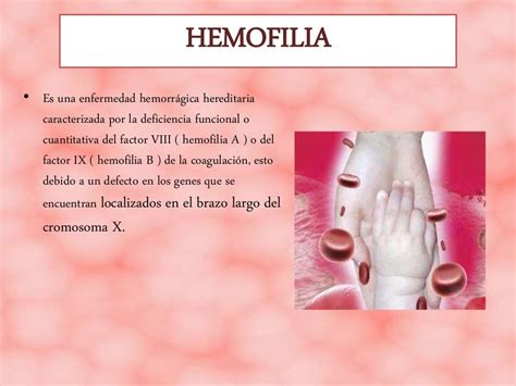 hem significado de hemofilia