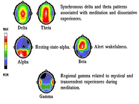 hemi-sync side effects