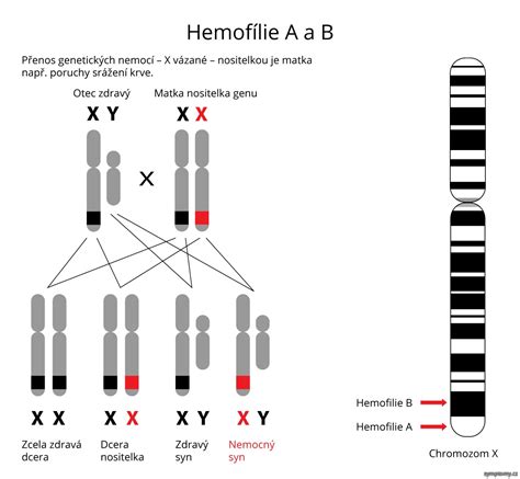 hemofilie betekenis