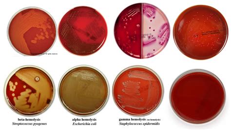 hemolytic patterns on blood agar