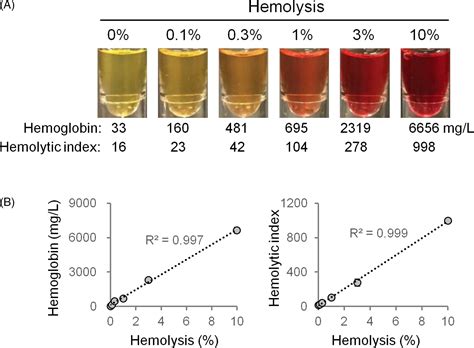 Hemolyzed Sample Creatinine