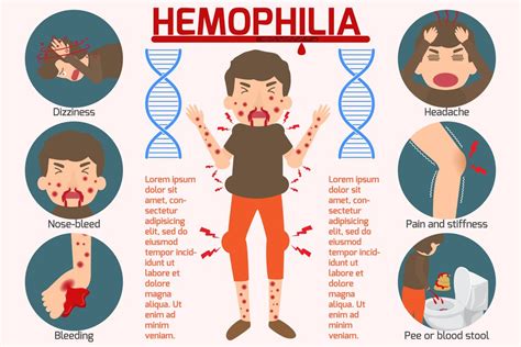 hemophilia a vs b symptoms