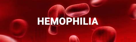 hemophilia wikipedia