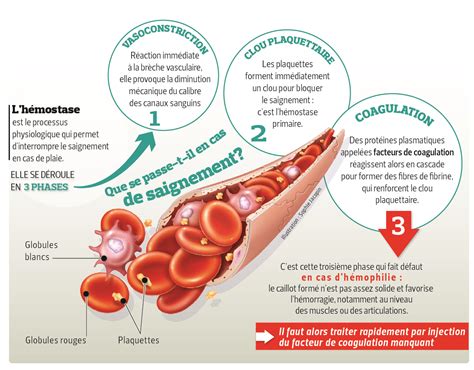 hemophilie