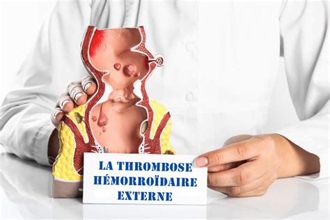 Comment maigrir du ventre 1 mois après l