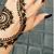 henna tattoo allergic reaction cure
