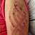 henna tattoo allergy scar