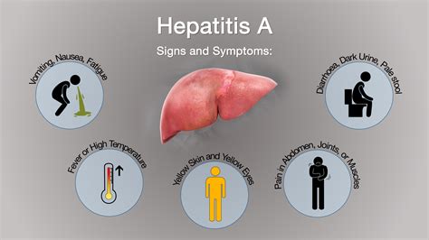 hepatitis a virus signs and symptoms