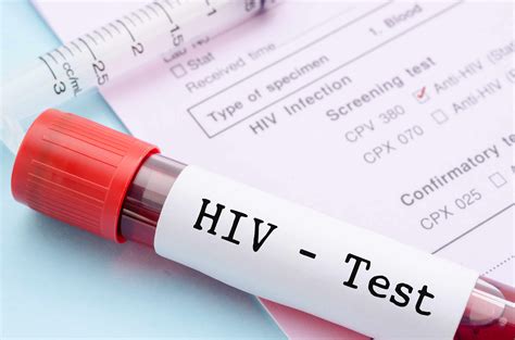 Hepatitis Hiv Test