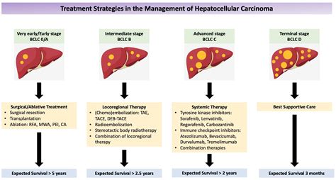 hepatocellular carcinoma guidelines 2022