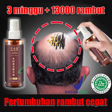 Temukan Rahasia Herbal Ajaib Penumbuh Rambut Botak, Rontok Minggir!