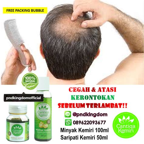 Rambut Rontok Rontok? Intip Rahasia Herbal yang Ampuh!