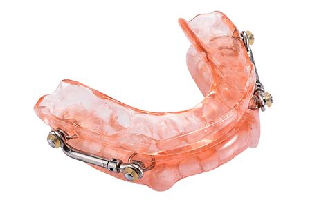 Herbst Appliance Alternative