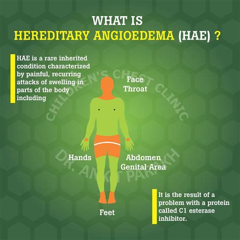 hereditary angioedema diagnosis