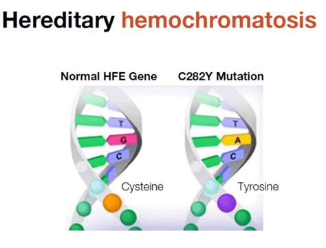 hereditary hemochromatosis dna mutation