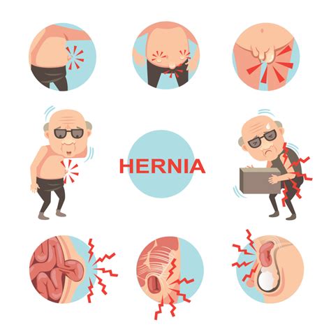 hernia disease in english