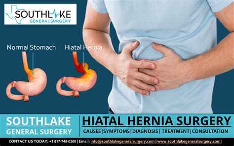 hernia in the esophagus surgery