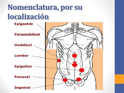 hernia inguinal donde se ubica