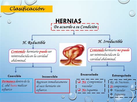 hernia inguinal no reductible