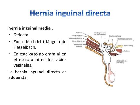 hernia inguino escrotal derecha