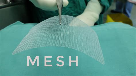 hernia mesh injury claims
