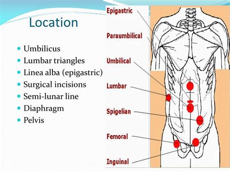hernia pain location male