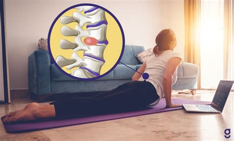 Herniated Disc Exercises To Help