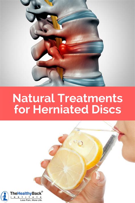 herniated disc pain treatment