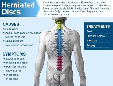 herniated disk in neck symptoms