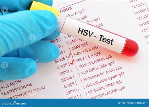 Accurate Herpes Simplex Blood Test: Diagnosis and Beyond Explained