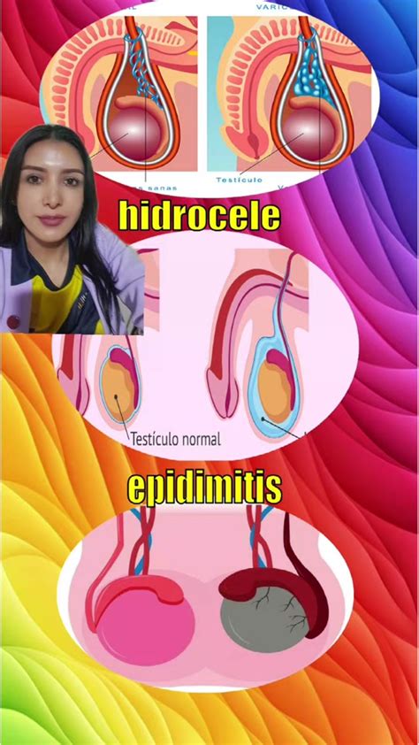 hidrocele
