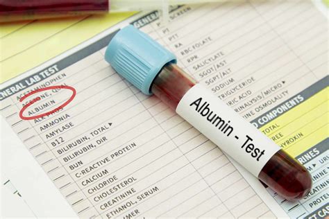 Albumin, Serum Test Smartly Labs