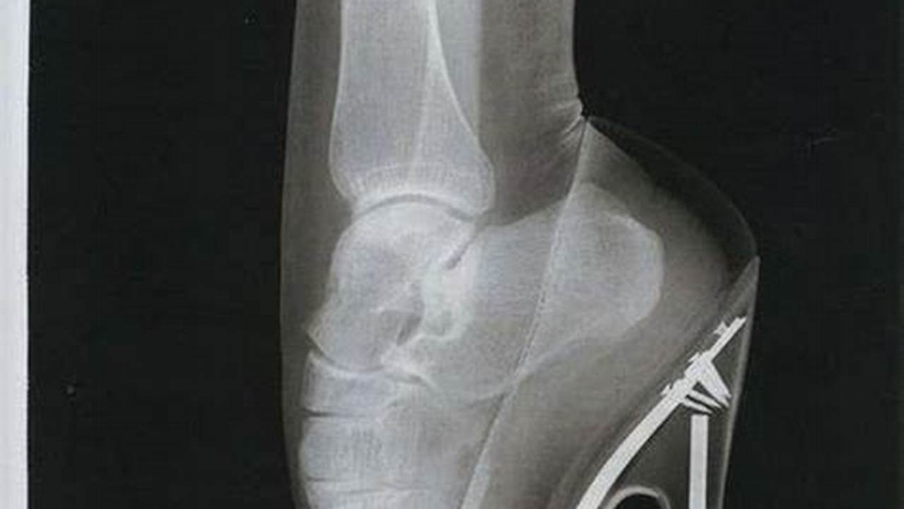 High Heel X-Ray