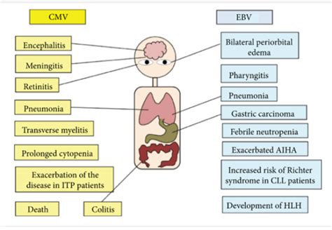 High Antibodies Epstein Barr
