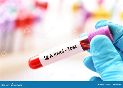 high iga blood test