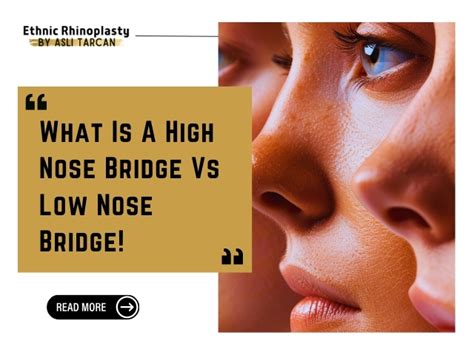 high nose bridge examples