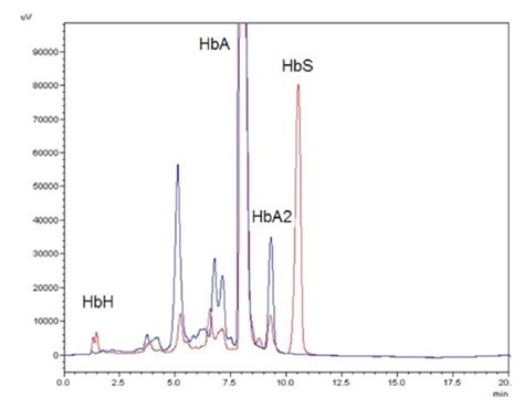 High Performance Liquid Chromatography For Hemoglobin