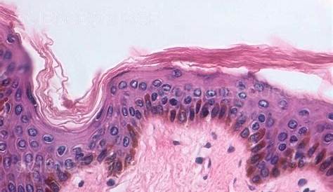 Highly Keratinized Stratified Squamous Epithelial Tissue Epithelium Thick Skin