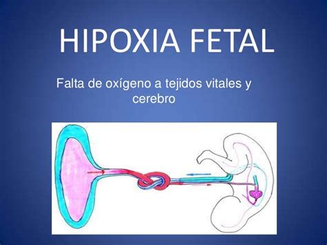 hipoxia fetal