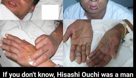 Unveiling The Horrific Truth: Hisashi Ouchi's Real Photos Revealed